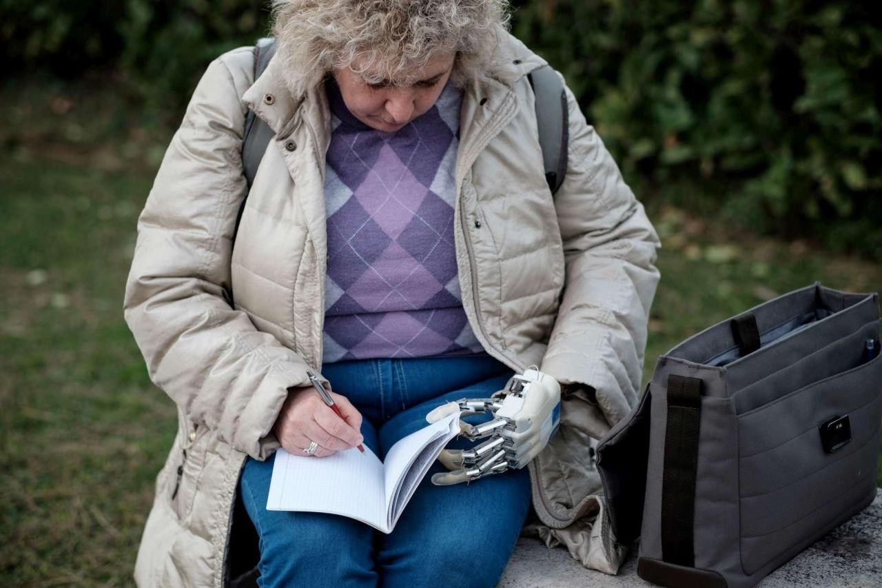 La mano bionica che riconosce gli oggetti impiantata ad una donna italiana